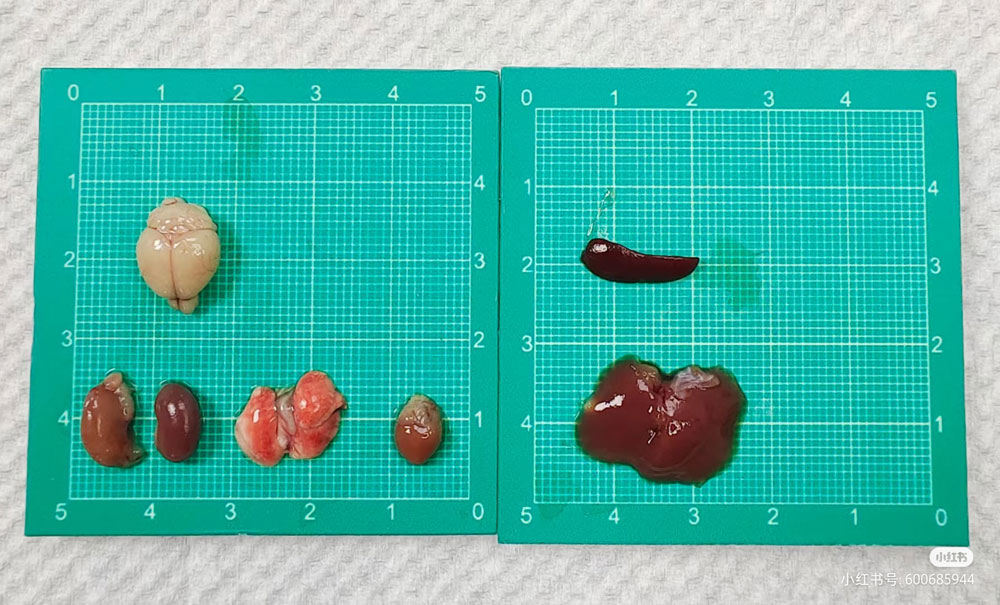 科學采集樣本之病理篇